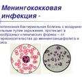 Профилактика менингококковой инфекции