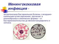 Профилактика менингококковой инфекции
