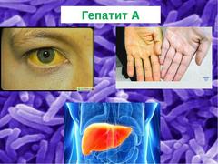 Профилактика вирусного гепатита А