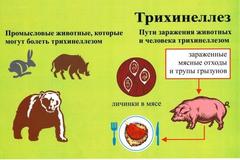 Трихинеллез