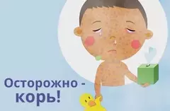 Осторожно! Корь!